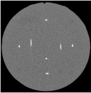 180px-CTP591_1mm_CT_Scan.jpg